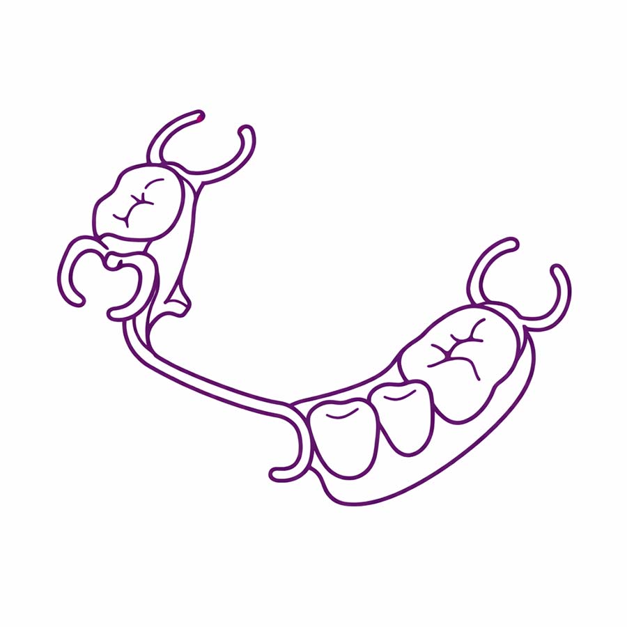 Partial denture Dentures Noyce Denture Clinic Christies Beach Adelaide