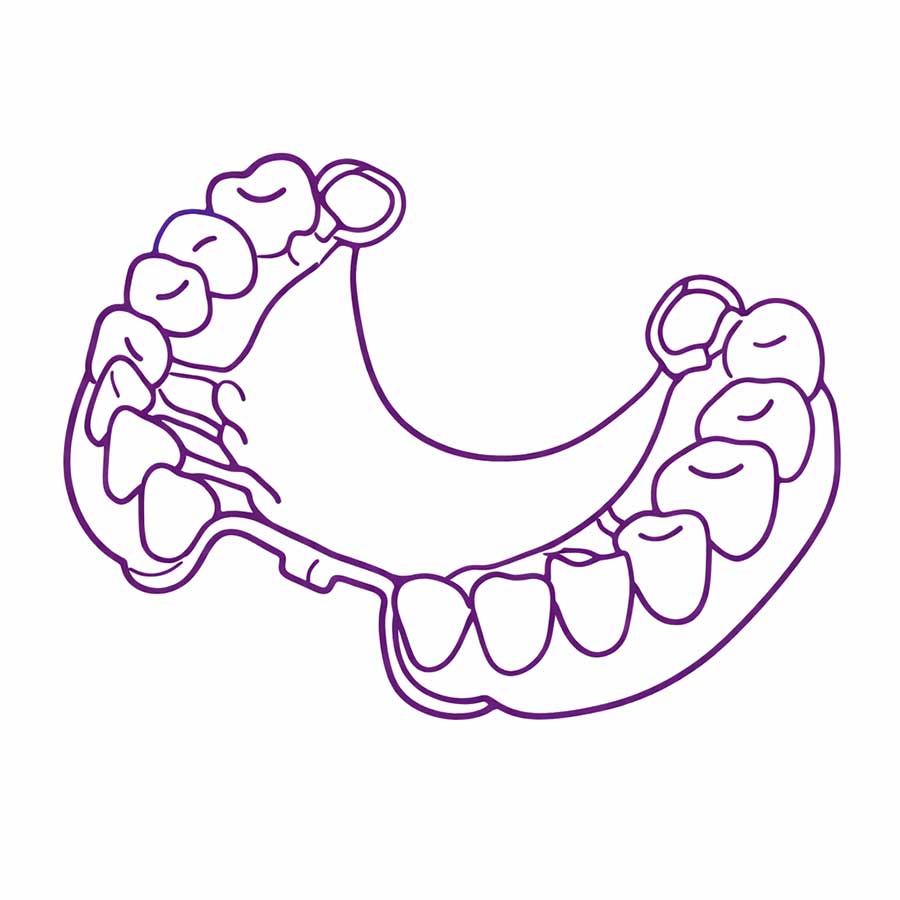 chrome dentures Noyce Denture Clinic Christies Beach Adelaide chrome dentures Noyce Denture Clinic Christies Beach Adelaide
