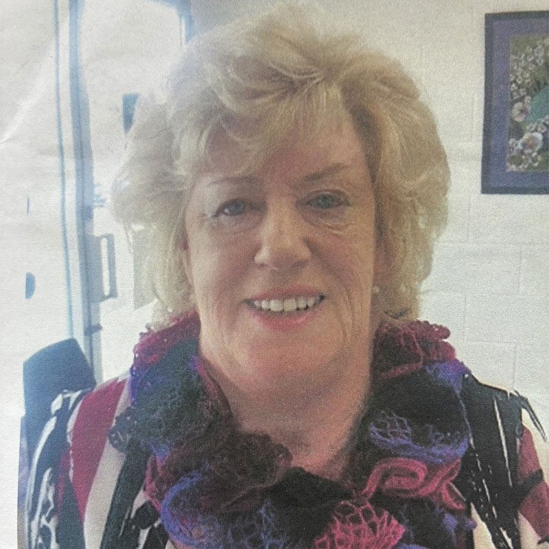 Full Dentures Noyce Denture Clinic Services Christies Beach Adelaide